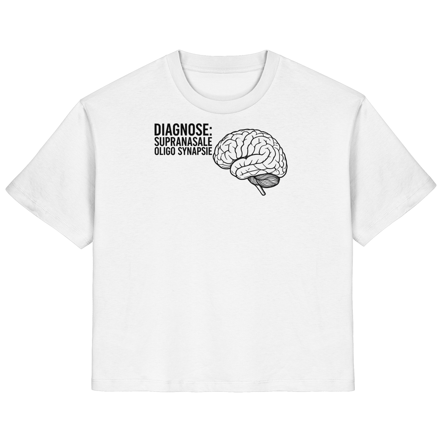 Diagnose: Supranasale Olingo Synapsie - Medizinhumor - Ladies Organic Shirt